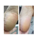 Kit Spa dos Pés Repos Amaciante 150ml + Espatula 222 + Creme 120gr