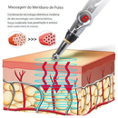 Caneta De Acupuntura Elétrica Para Alívio De Dores Terapia Estimulante Fisioterapia Pulsos Elétricos